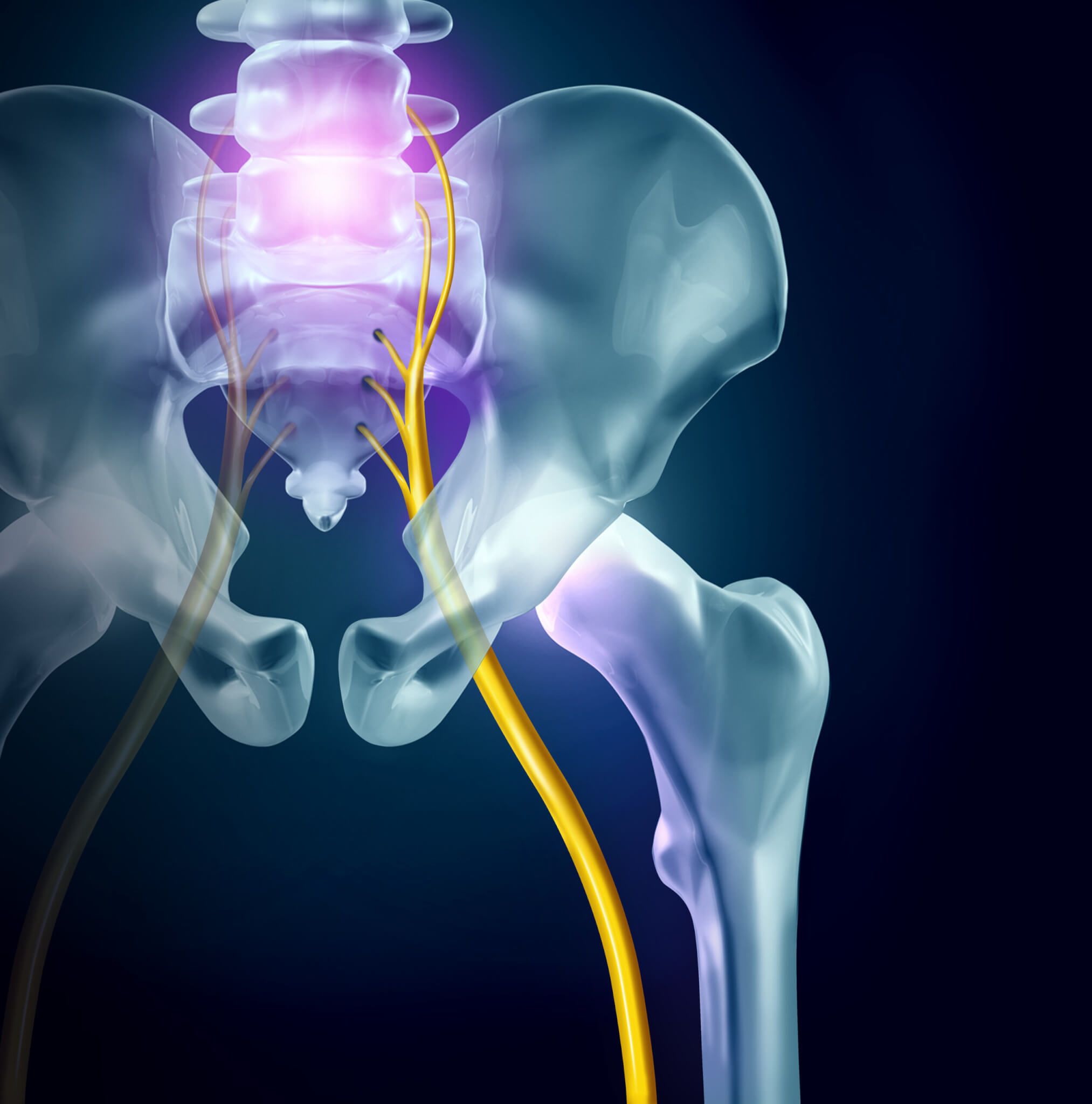 An anatomical illustration showing the location of the sciatica nerve (Starting at the lower back and running through the hips and thighs)